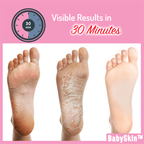 BabySkin™ Ultimate Foot Peeling Mask