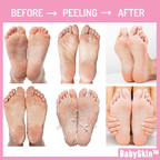 BabySkin™ Ultimate Foot Peeling Mask
