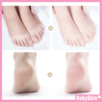 BabySkin™ Ultimate Foot Peeling Mask
